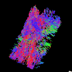 Tractography image of diffusion data taken on 16.4 T machine for a 3mm core of prostate tissue